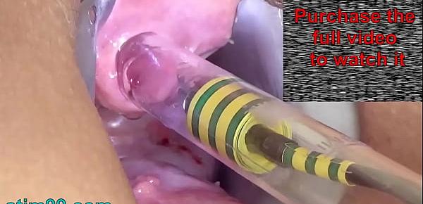  Woman Pee Hole Playing, Urethral Insertion with Endoscope Cam